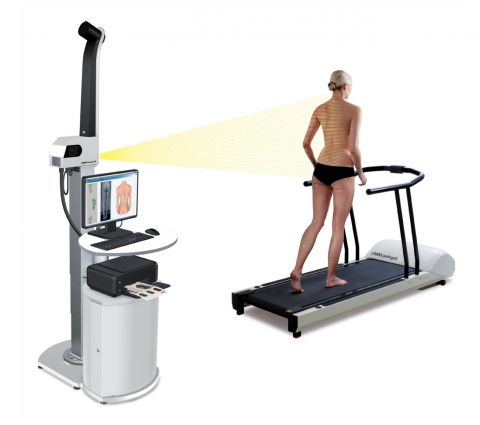Diers 4d motion scan